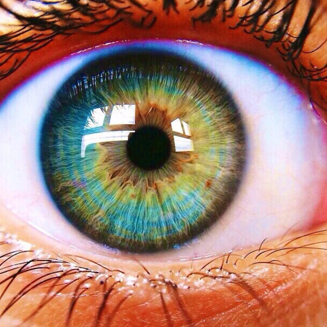 Пестрые глаза. Центральная гетерохромия карих глаз. Центральная гетерохромия зеленый Карий. Центральная гетерохромия радужной оболочки глаза. Центральная гетерохромия глаз Карий и зеленый.