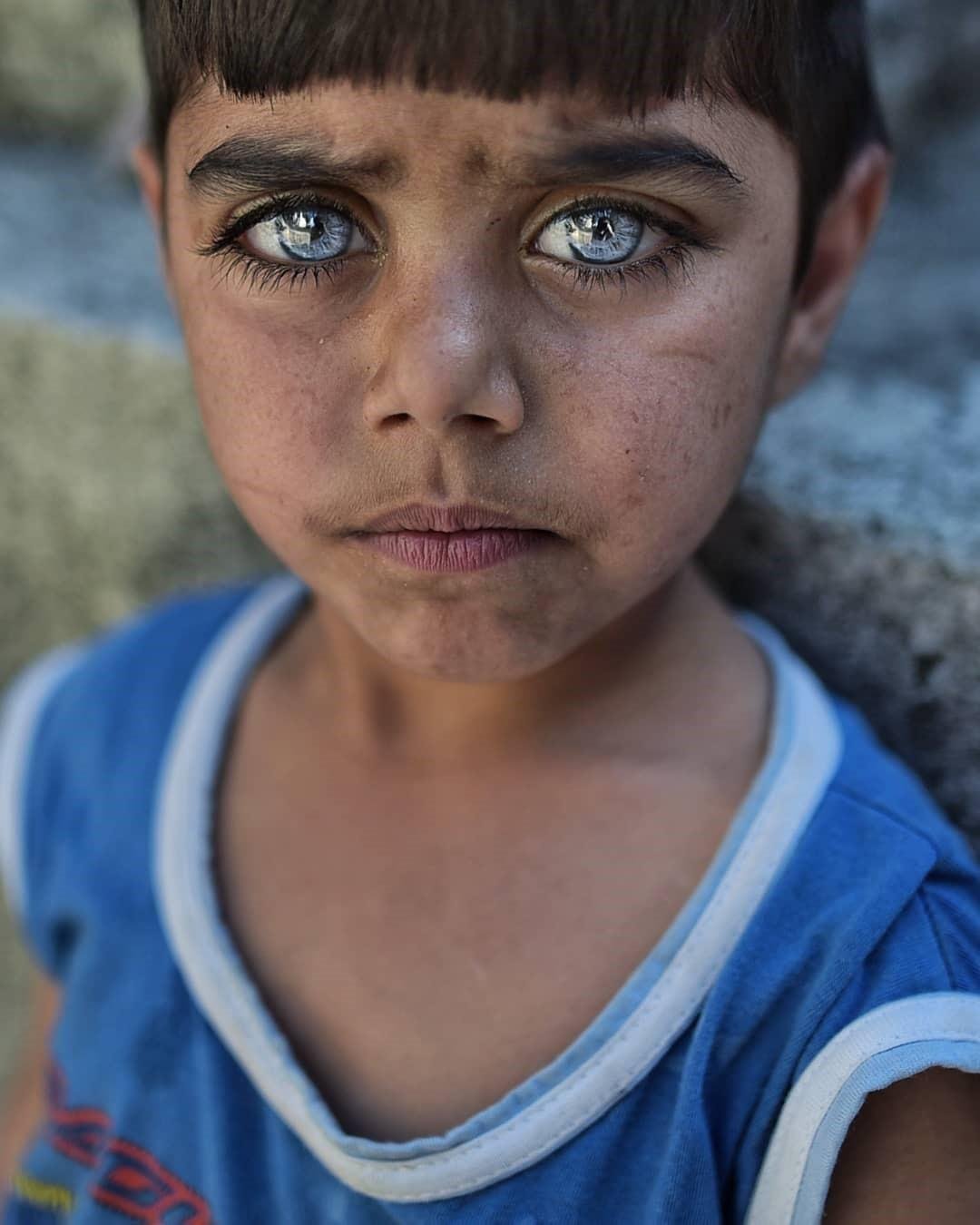 Самого редкого человека. Абдулла Айдемир турецкий фотограф. Необычные глаза. Люди с необычным цветом глаз. Необычный цвет глаз.