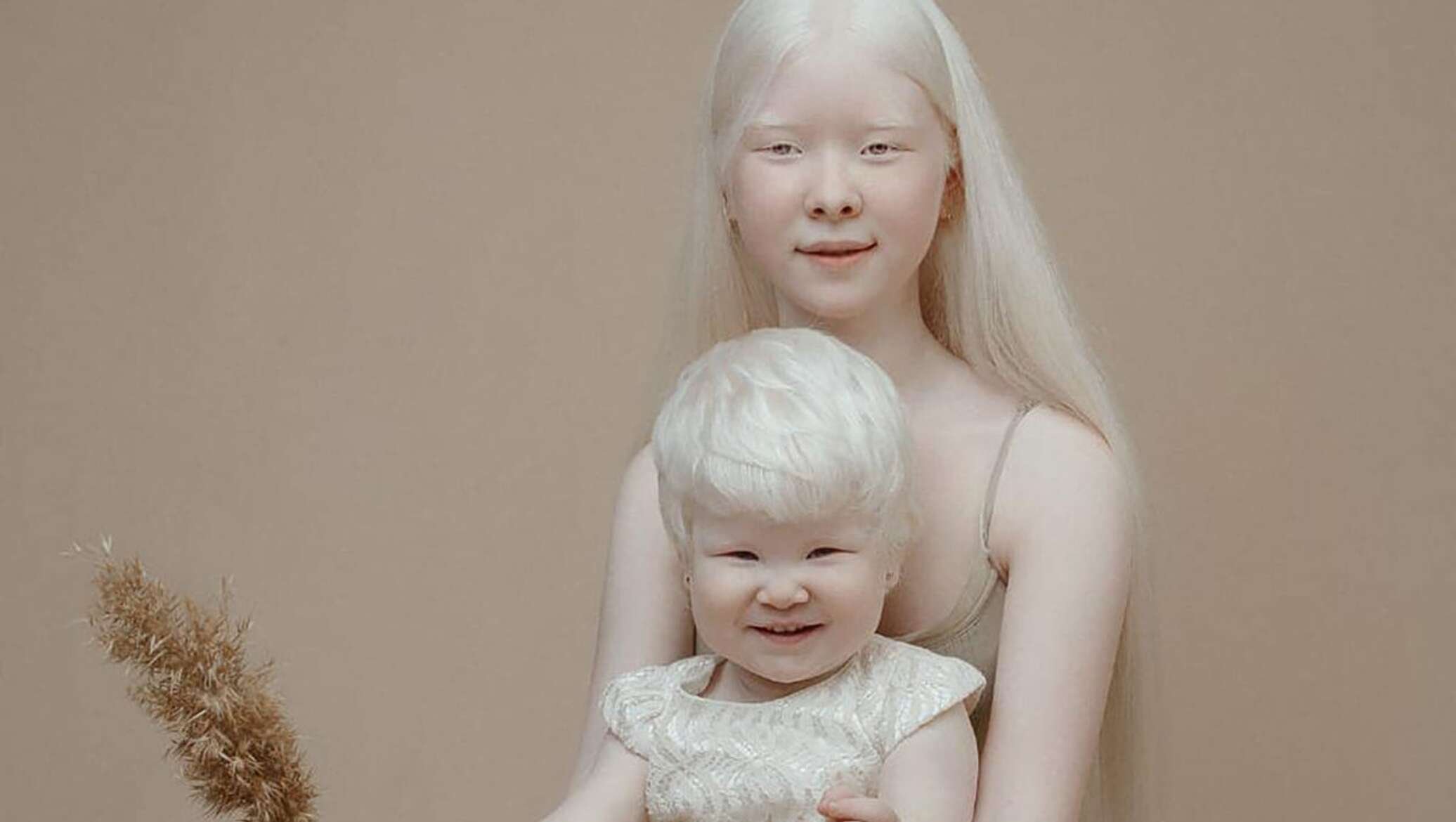 Как люди рождаются альбиносами. Монголоиды альбиносы. Альбиносы из Казахстана.