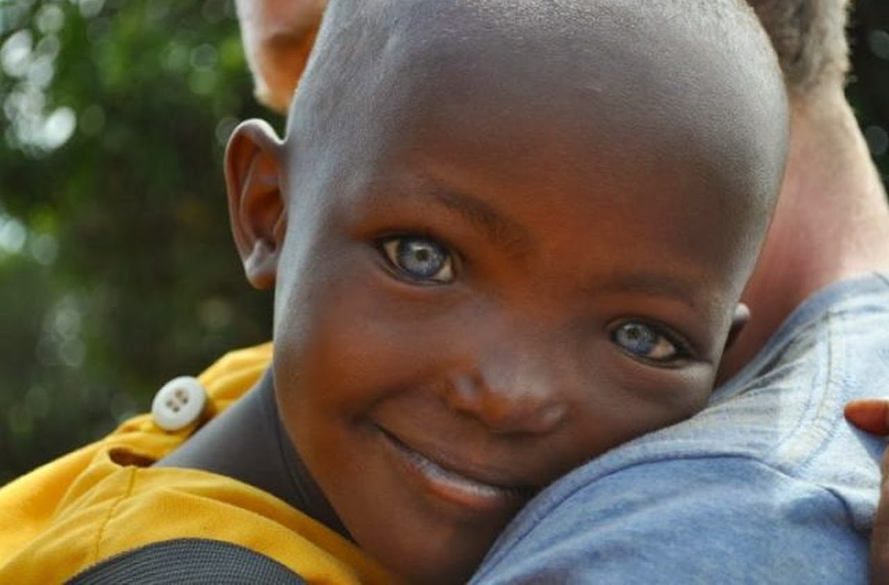 Глаза у негроидной расы. Африканцы негроидная раса. Африканцы с голубыми глазами. Темнокожие со светлыми глазами. Темнокожие с зелеными глазами.