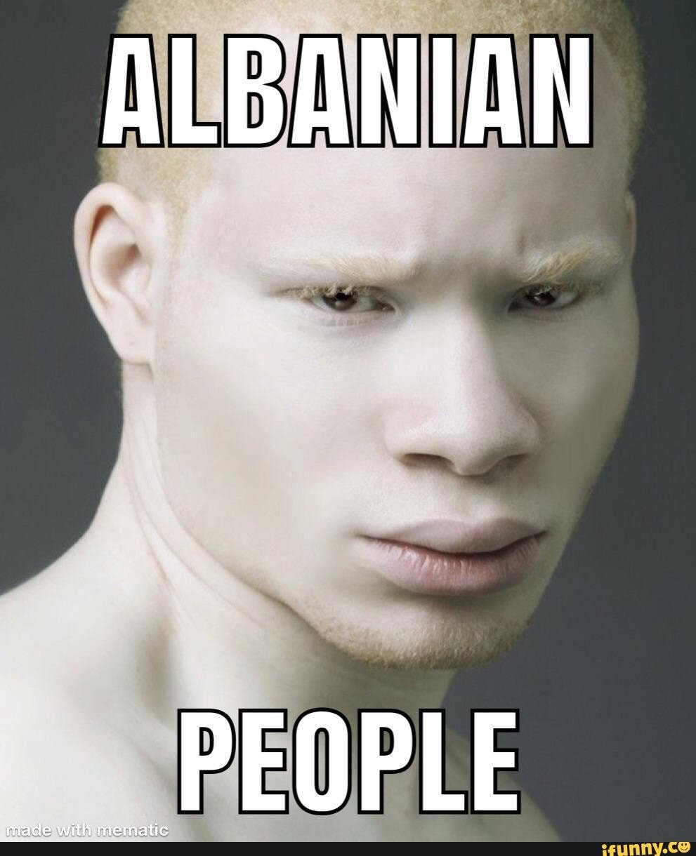 Белый негр. Сэр Маджор пейдж. Джуэл Джеффри фотомодель альбинос. Пауль актер альбинос. Мулат альбинос.