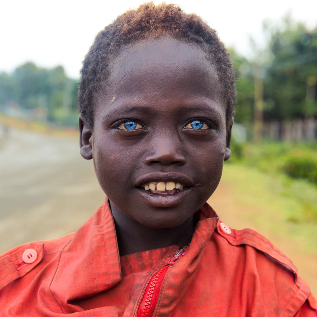 Негритянка и пацан. Африканцы негроидная раса. Чернокожие с голубыми глазами. Африканка с голубыми глазами. Эфиопы с голубыми глазами.