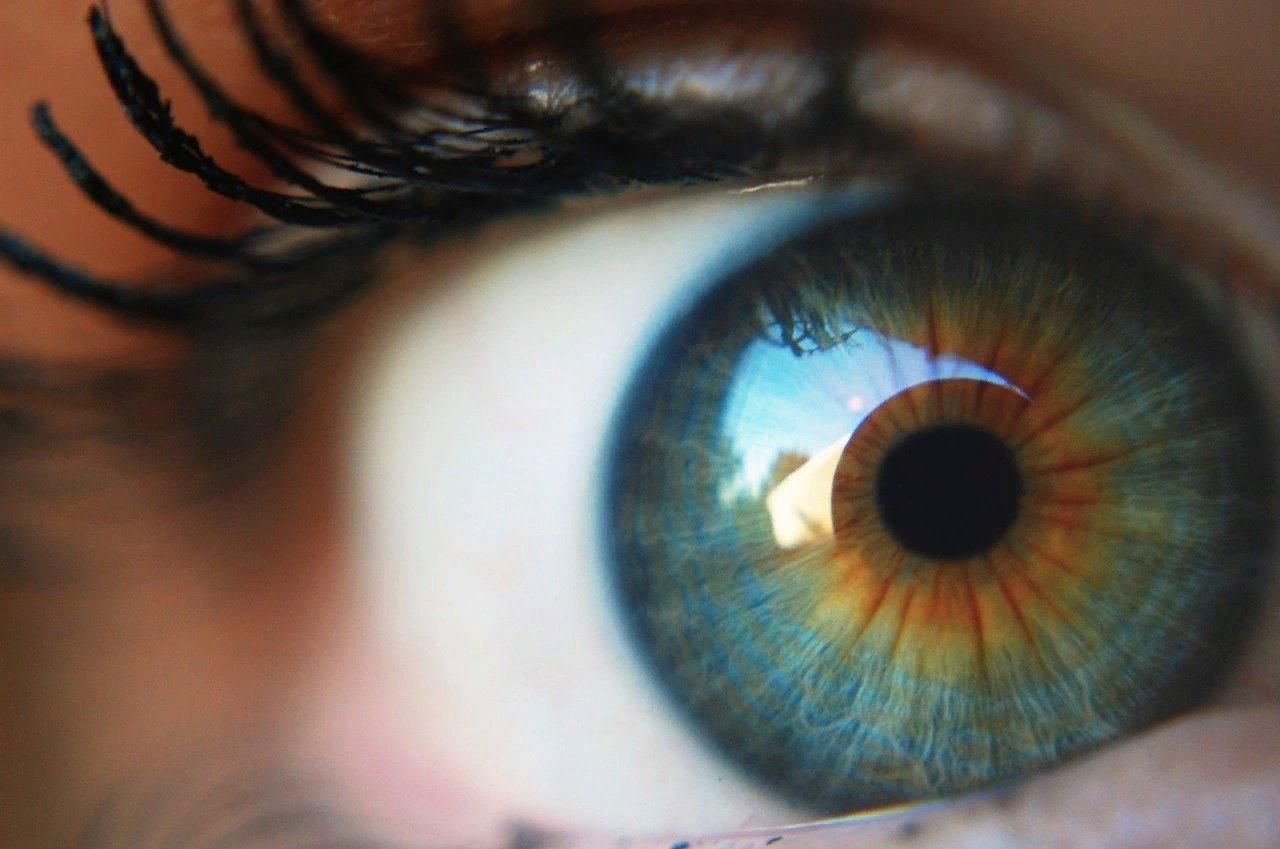 Second eye. Центральная гетерохромия глаз. Центральная гетерохромия зеленый Карий. Центральная гетерохромия карих глаз. Гетерохромия Радужки глаз.