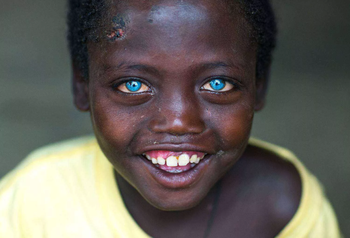 негр азиат с голубыми глазами (120) фото